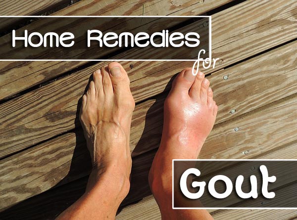 Top 12 Home Remedies for Gout  Starsricha